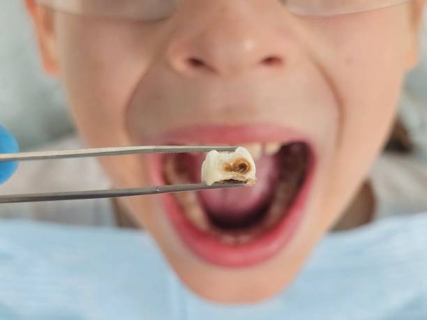 Best 24-Hour Emergency Dentist in Taylorvle, IL