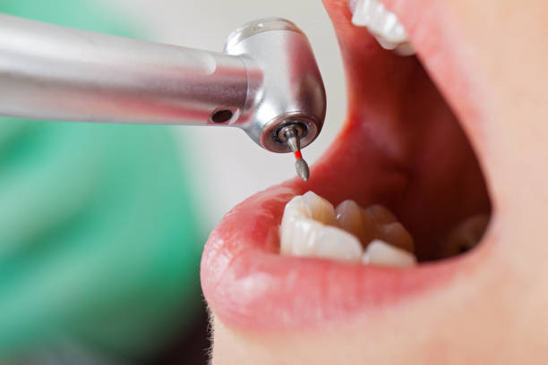 Best Emergency Denture Repair in Taylorvle, IL